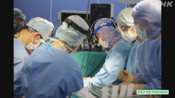 일본 교토대학 의학부 부속병원이 서로 다른 혈액형 사이의 생체 폐 이식을 세계 최초로 성공했다(사진 출처 - NHK)