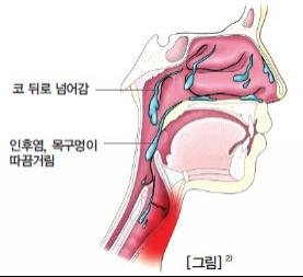 매핵기에 사용되는 ‘반하후박탕’ < 나의복약 지도노트 < 기획·연재 < 기사본문 - 한국의약통신